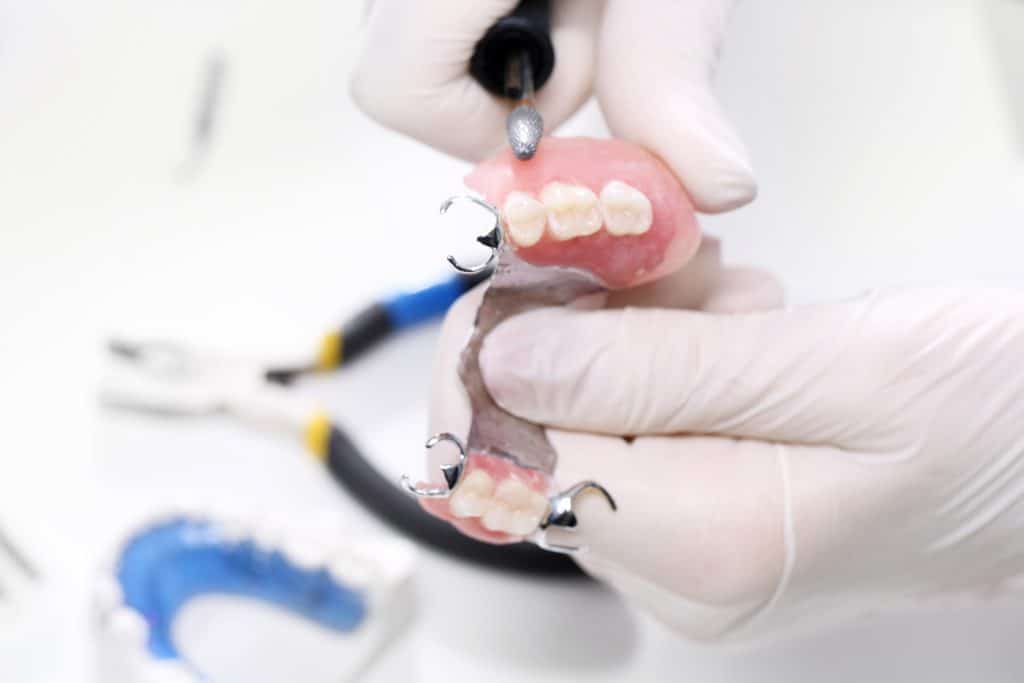 What Are The Four Types of Dental Implants? Which is Right for You?