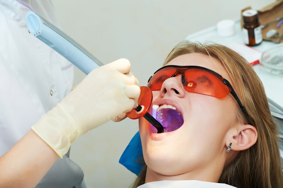 Dental Sealants Explained: When and Why to Seal Teeth