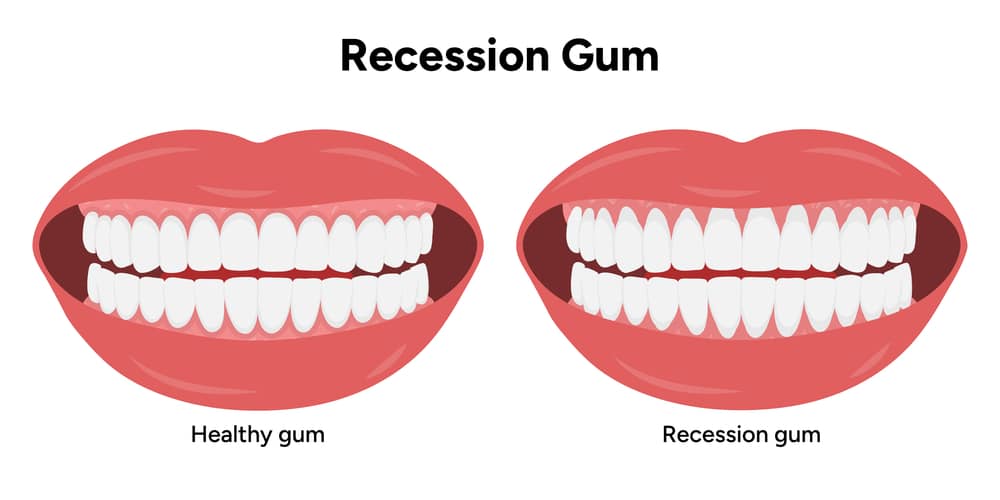 Why Are My Teeth Suddenly Sensitive? 10 Common Causes